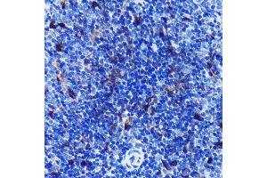 Immunohistochemistry (IHC) image for anti-S100 Calcium Binding Protein B (S100B) antibody (ABIN7270131)
