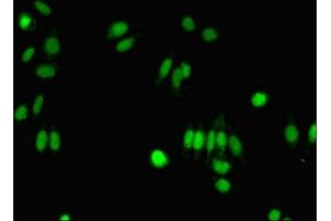 Immunofluorescent analysis of HepG2 cells using ABIN7143007 at dilution of 1:100 and Alexa Fluor 488-congugated AffiniPure Goat Anti-Rabbit IgG(H+L) (FIBP 抗体  (AA 2-357))