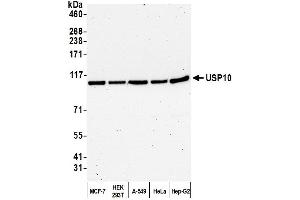 Western Blotting (WB) image for anti-Ubiquitin Specific Peptidase 10 (USP10) (AA 50-100) antibody (ABIN7453890) (USP10 抗体  (AA 50-100))