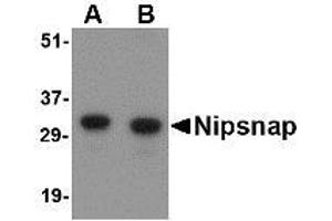 Image no. 1 for anti-4-Nitrophenylphosphatase Domain and Non-Neuronal SNAP25-Like Protein Homolog 1 (NIPSNAP1) (Internal Region) antibody (ABIN1493790) (NIPSNAP1 抗体  (Internal Region))