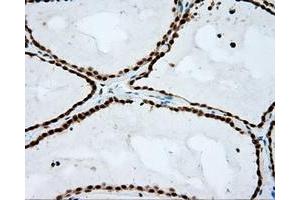 Immunohistochemistry (IHC) image for anti-Atrial Natriuretic Peptide Receptor 3 (NPR3) antibody (ABIN1499804) (NPR3 抗体)