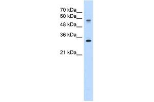 WB Suggested Anti-SLC22A1 Antibody Titration:  5. (SLC22A1 抗体  (C-Term))