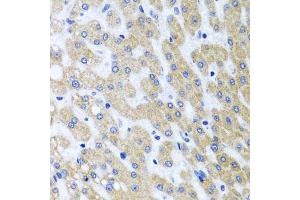 Immunohistochemistry of paraffin-embedded human liver injury using PRMT2 antibody (ABIN5973447) at dilution of 1/100 (40x lens). (PRMT2 抗体)