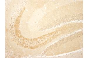 Immunohistochemistry (IHC) image for anti-CREB Regulated Transcription Coactivator 1 (CRTC1) (C-Term) antibody (ABIN7448839) (CRTC1 抗体  (C-Term))
