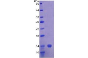 SDS-PAGE analysis of Human CAP1 Protein. (CAP1 蛋白)