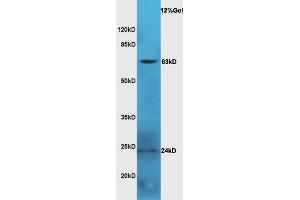 Mouse serum lysate probed with Anti LGALS3BP Polyclonal Antibody, Unconjugated  at 1:3000 for 90 min at 37˚C. (LGALS3BP 抗体  (AA 301-400))