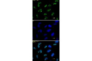 Histone H3 trimethyl Lys9 antibody tested by immunofluorescence. (Histone 3 抗体  (3meLys9))