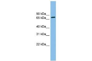 WB Suggested Anti-ODF2 Antibody Titration: 0. (ODF2 抗体  (N-Term))