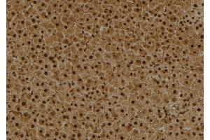 ABIN6273993 at 1/100 staining Rat liver tissue by IHC-P. (BCL6 抗体  (Internal Region))
