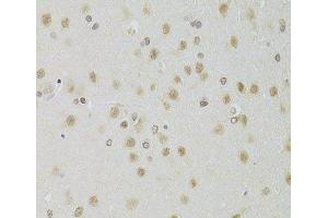 Immunohistochemistry of paraffin-embedded Rat brain using HEXIM1 Polyclonal Antibody at dilution of 1:100 (40x lens). (HEXIM1 抗体)