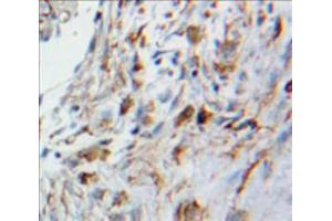 Used in DAB staining on fromalin fixed paraffin-embedded Lung tissue (HMOX2 抗体  (AA 41-292))