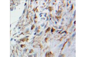 Used in DAB staining on fromalin fixed paraffin-embedded Lung tissue (HMOX2 抗体  (AA 41-292))