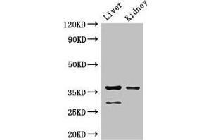 Western Blot Positive WB detected in: Mouse liver tissue, Mouse kidney tissue All lanes: PPP2CA antibody at 2. (PPP2CA 抗体  (Catalytic Subunit alpha))
