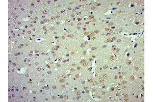 Paraformaldehyde-fixed, paraffin embedded mouse brain; Antigen retrieval by boiling in sodium citrate buffer (pH6. (TRPM4 抗体  (AA 800-850))