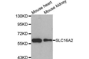 Western blot analysis of extracts of various cell lines, using SLC16A2 antibody. (SLC16A2/MCT8 抗体  (AA 1-100))