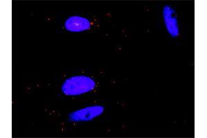 Proximity Ligation Analysis of protein-protein interactions between GRAP2 and CSF1R. (CSF1R 抗体  (AA 21-120))