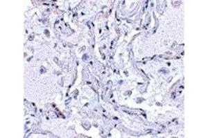 Immunohistochemistry (IHC) image for anti-Transition Protein 1 (During Histone To Protamine Replacement) (TNP1) (N-Term) antibody (ABIN1031638) (TNP1 抗体  (N-Term))
