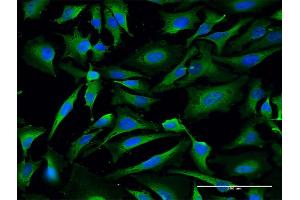 Immunofluorescence of purified MaxPab antibody to LDHA on HeLa cell. (Lactate Dehydrogenase A 抗体  (AA 1-332))