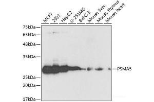 Western blot analysis of extracts of various cell lines using PSMA5 Polyclonal Antibody at dilution of 1:1000. (PSMA5 抗体)