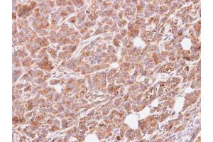 IHC-P Image Immunohistochemical analysis of paraffin-embedded SAS xenograft, using G protein alpha Inhibitor 3, antibody at 1:500 dilution. (G Protein alpha Inhibitor 3 (Center) 抗体)