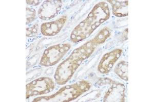 Immunohistochemistry of paraffin-embedded rat kidney using [KO Validated] NDUFB4 Rabbit pAb (ABIN6133349, ABIN6144476, ABIN6144477 and ABIN7101430) at dilution of 1:150 (40x lens). (NDUFB4 抗体  (AA 1-90))