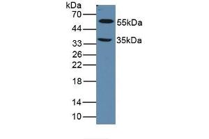Detection of LOXL1 in Mouse Eye Tissue using Polyclonal Antibody to Lysyl Oxidase Like Protein 1 (LOXL1) (LOXL1 抗体  (AA 392-598))