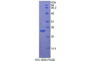 SDS-PAGE (SDS) image for Fibroblast Growth Factor 13 (FGF13) (AA 1-192) protein (His tag) (ABIN1821710) (FGF13 Protein (AA 1-192) (His tag))
