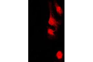 Immunofluorescent analysis of AKAP13 staining in HeLa cells. (AKAP13 抗体  (Center))