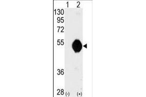 Western blot analysis of DOK2 (arrow) using DOK2 Antibody (C-term) (ABIN392072 and ABIN2841834). (DOK2 抗体  (C-Term))
