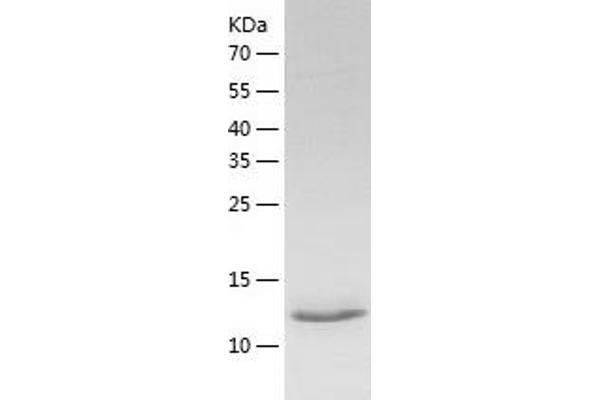 BAZ1B Protein (AA 1335-1450) (His tag)