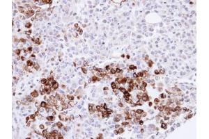 IHC-P Image Immunohistochemical analysis of paraffin-embedded H1299 xenograft, using Gelsolin, antibody at 1:500 dilution. (Gelsolin 抗体  (C-Term))