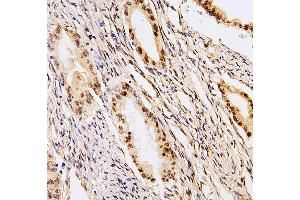 IHC analysis of PHF21A using anti-PHF21A antibody (ABIN6719353). (PHF21A 抗体  (AA 1-97))