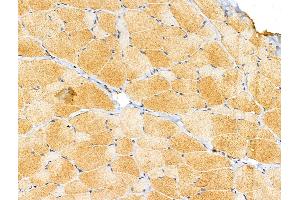 ABIN6257350 and ABIN6274727 at 1/100 staining Rat skin tissue by IHC-P. (MRPL11 抗体  (Internal Region))