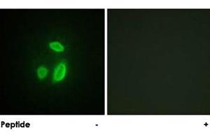 Immunofluorescence analysis of HUVEC cells, using ESPL1 polyclonal antibody . (Separase 抗体)