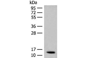 Western blot analysis of Human fetal brain tissue lysate using AKAP7 Polyclonal Antibody at dilution of 1:200 (AKAP7 抗体)