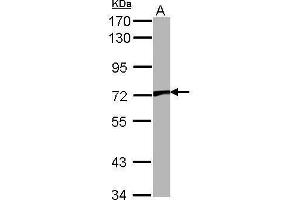 Western Blotting (WB) image for anti-Transient Receptor Potential Cation Channel, Subfamily V, Member 2 (TRPV2) (C-Term) antibody (ABIN2855207)