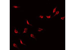 ABIN6268958 staining Hela by IF/ICC. (LCK 抗体  (N-Term))
