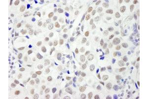Immunohistochemistry (IHC) image for anti-DNA Fragmentation Factor, 45kDa, alpha Polypeptide (DFFA) (AA 271-331) antibody (ABIN7448951)