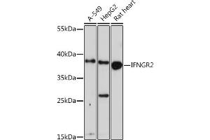 Western blot analysis of extracts of various cell lines, using IFNGR2 Rabbit pAb (ABIN6134791, ABIN6142199, ABIN6142201 and ABIN6218514) at 1:1000 dilution. (IFNGR2 抗体  (C-Term))