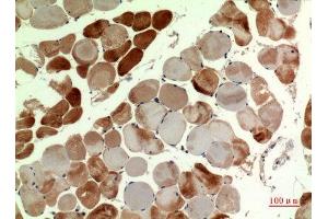Immunohistochemistry (IHC) analysis of paraffin-embedded Human Muscle, antibody was diluted at 1:100. (MUTYH 抗体  (pan))
