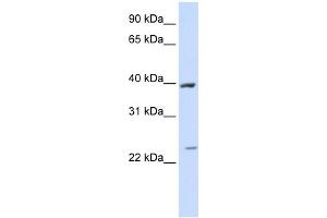 WB Suggested Anti-ACADL Antibody Titration:  0. (ACADL 抗体  (Middle Region))