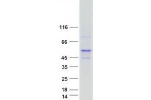 Validation with Western Blot