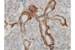 Immunostaining (ISt) image for anti-Protocadherin 1 (PCDH1) (AA 62-169) antibody (ABIN562123)