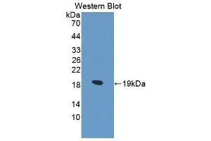 Western Blotting (WB) image for anti-Collagen, Type VI, alpha 1 (COL6A1) (AA 828-1022) antibody (ABIN1175577) (COL6A1 抗体  (AA 828-1022))