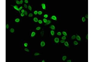 Immunofluorescence (IF) image for anti-Histone Cluster 1, H4a (HIST1H4A) (meLys5) antibody (ABIN7139604)