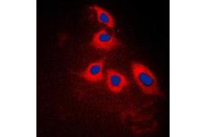 Immunofluorescent analysis of ARRDC3 staining in Jurkat cells. (ARRDC3 抗体  (C-Term))
