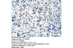 Rabbit Anti-HNRPA0 Antibody  Paraffin Embedded Tissue: Human Liver Cellular Data: Hepatocytes Antibody Concentration: 4. (HNRNPA0 抗体  (Middle Region))