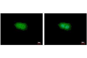 ICC/IF Image p90 RSK1 antibody detects p90 RSK1 protein at Cytoplasm and Nucleus by immunofluorescent analysis. (RPS6KA1 抗体  (Center))
