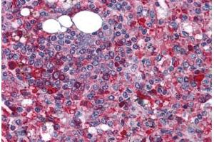 Human Spleen: Formalin-Fixed, Paraffin-Embedded (FFPE) (Anoctamin 2 抗体  (N-Term))