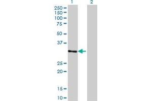 Western Blot analysis of ZNF397 expression in transfected 293T cell line by ZNF397 monoclonal antibody (M02), clone 1F8. (ZNF397 抗体  (AA 131-230))